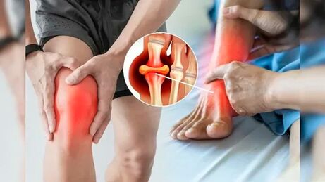 Zone de piele potrivite pentru aplicarea gelului Icexin (genunchi, coate, spate)