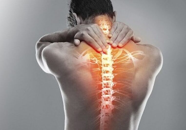 Cu osteocondroza toracică, structura țesutului osos al vertebrelor se modifică