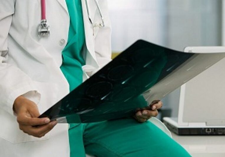 Raze X vor ajuta medicul să diagnosticheze „osteocondroza coloanei vertebrale toracice”